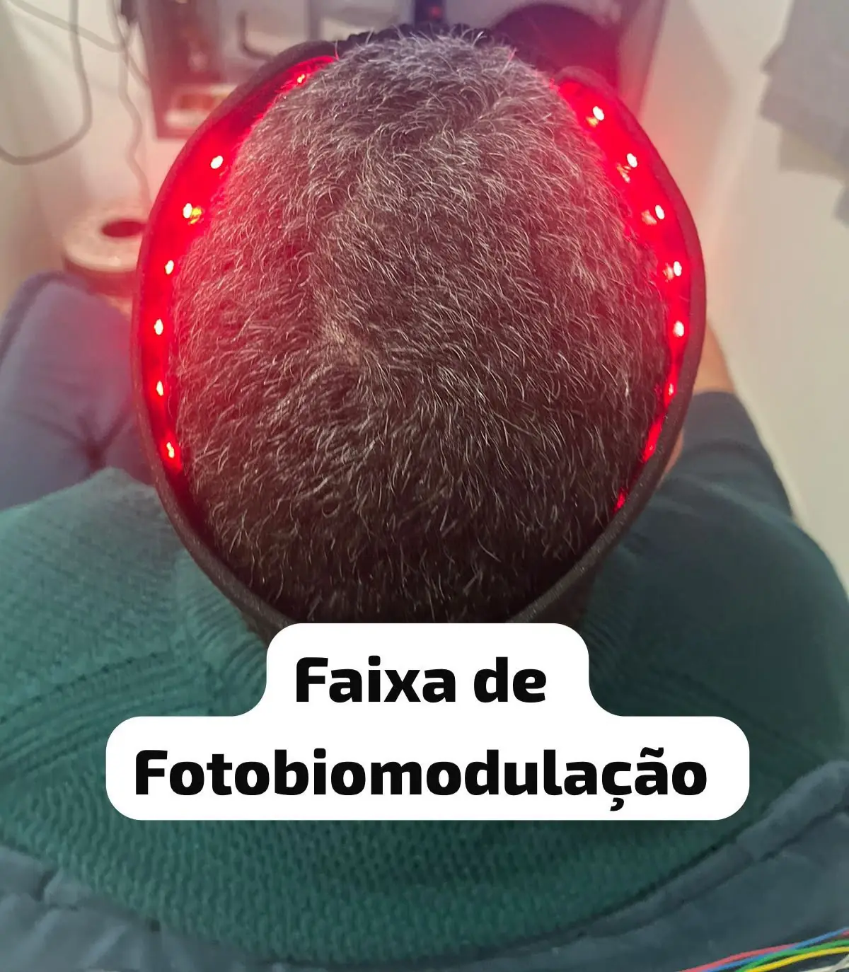 Aplicação de faixa de fotobiomodulação